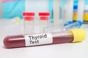 Image of thyroid blood test vial